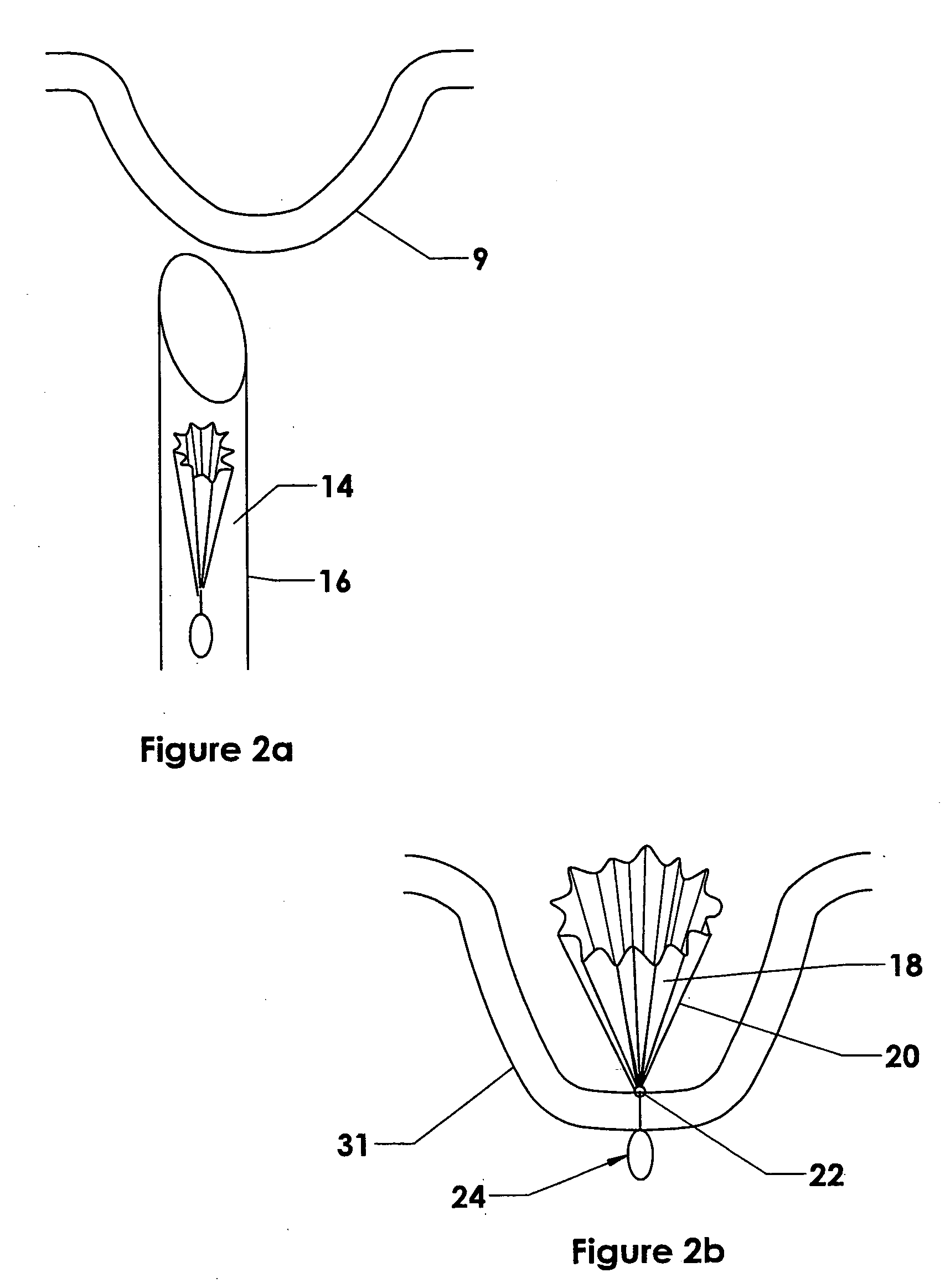 Methods and devices for anchoring to soft tissue