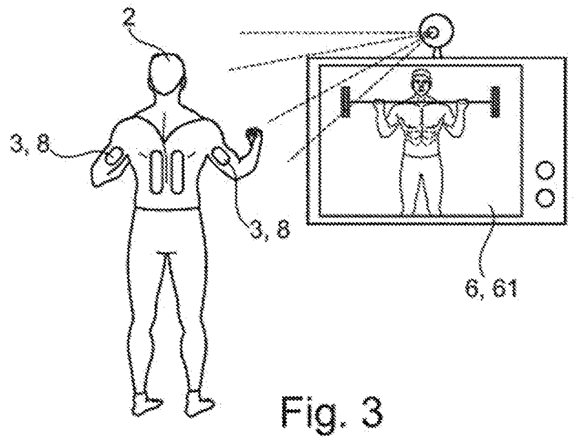 User interface for use with an electrostimulation system