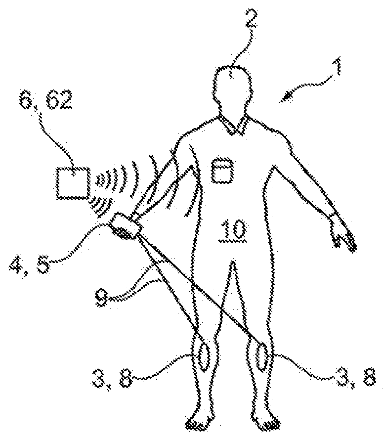 User interface for use with an electrostimulation system