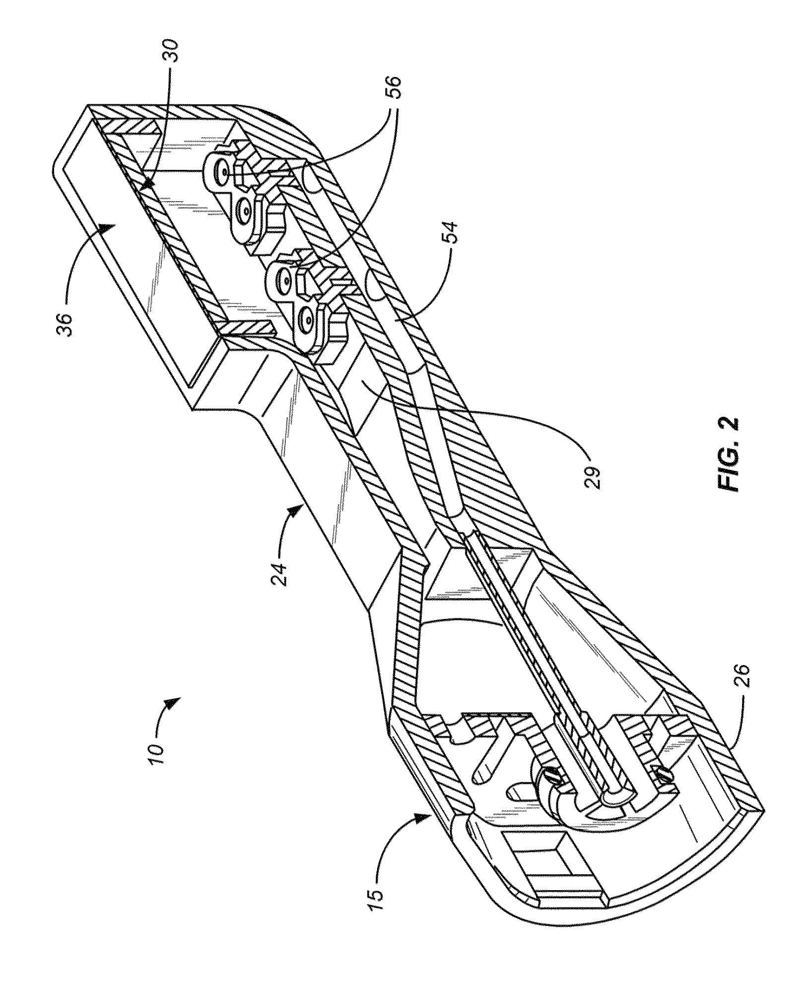 Vaginal remodeling device and methods