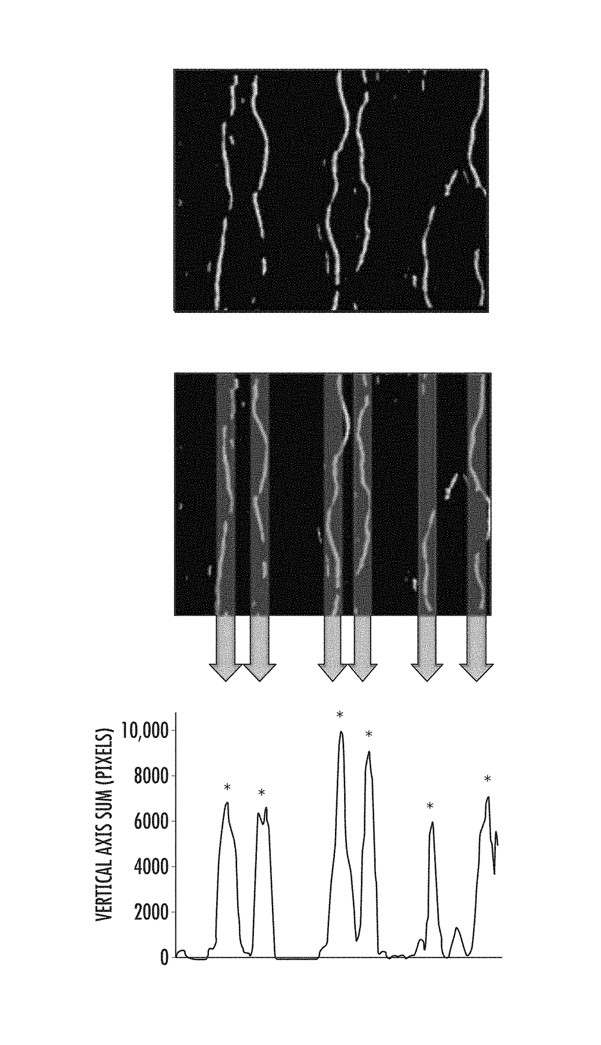 Automated methods to count corneal subbasal nerves