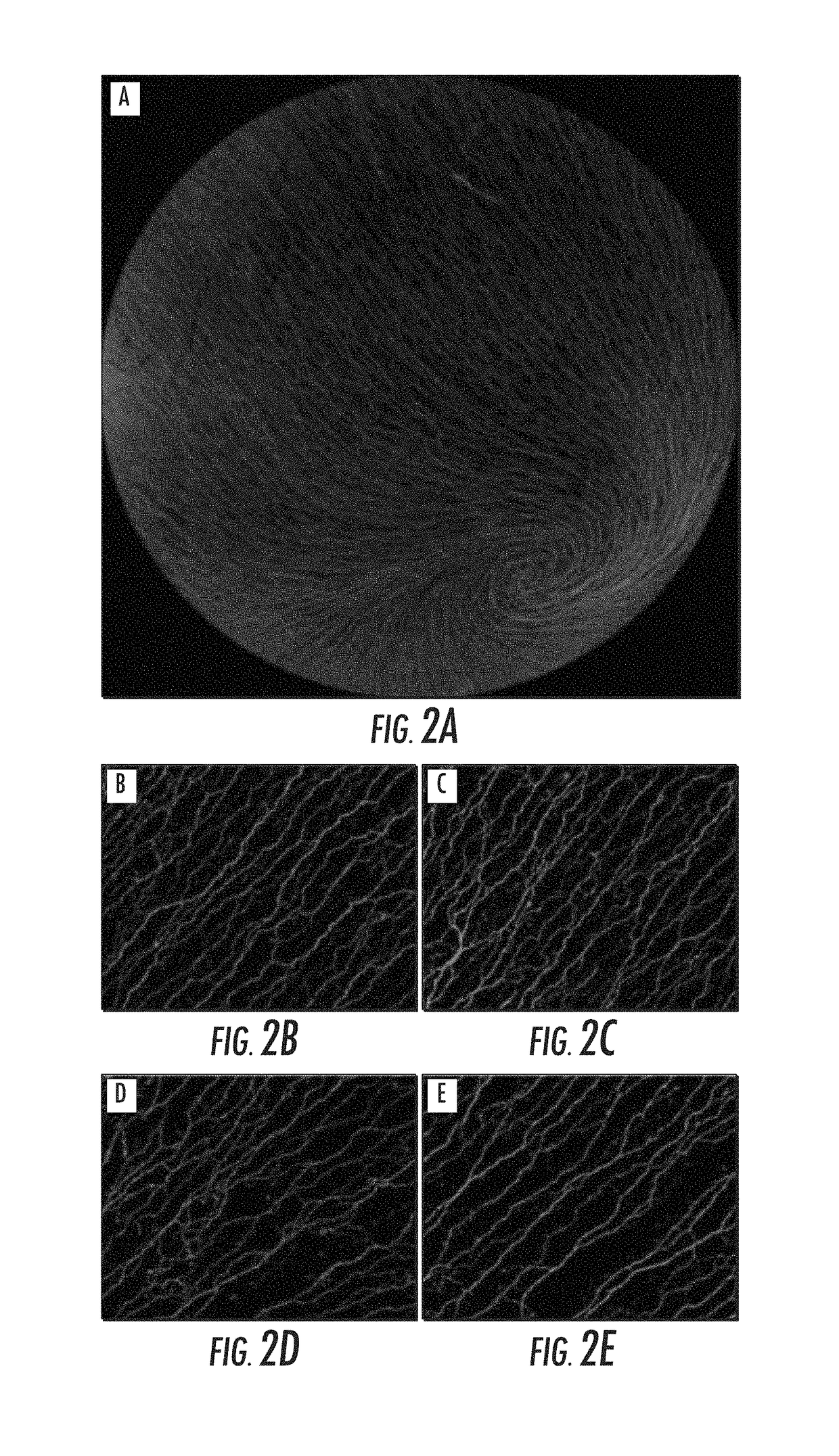 Automated methods to count corneal subbasal nerves