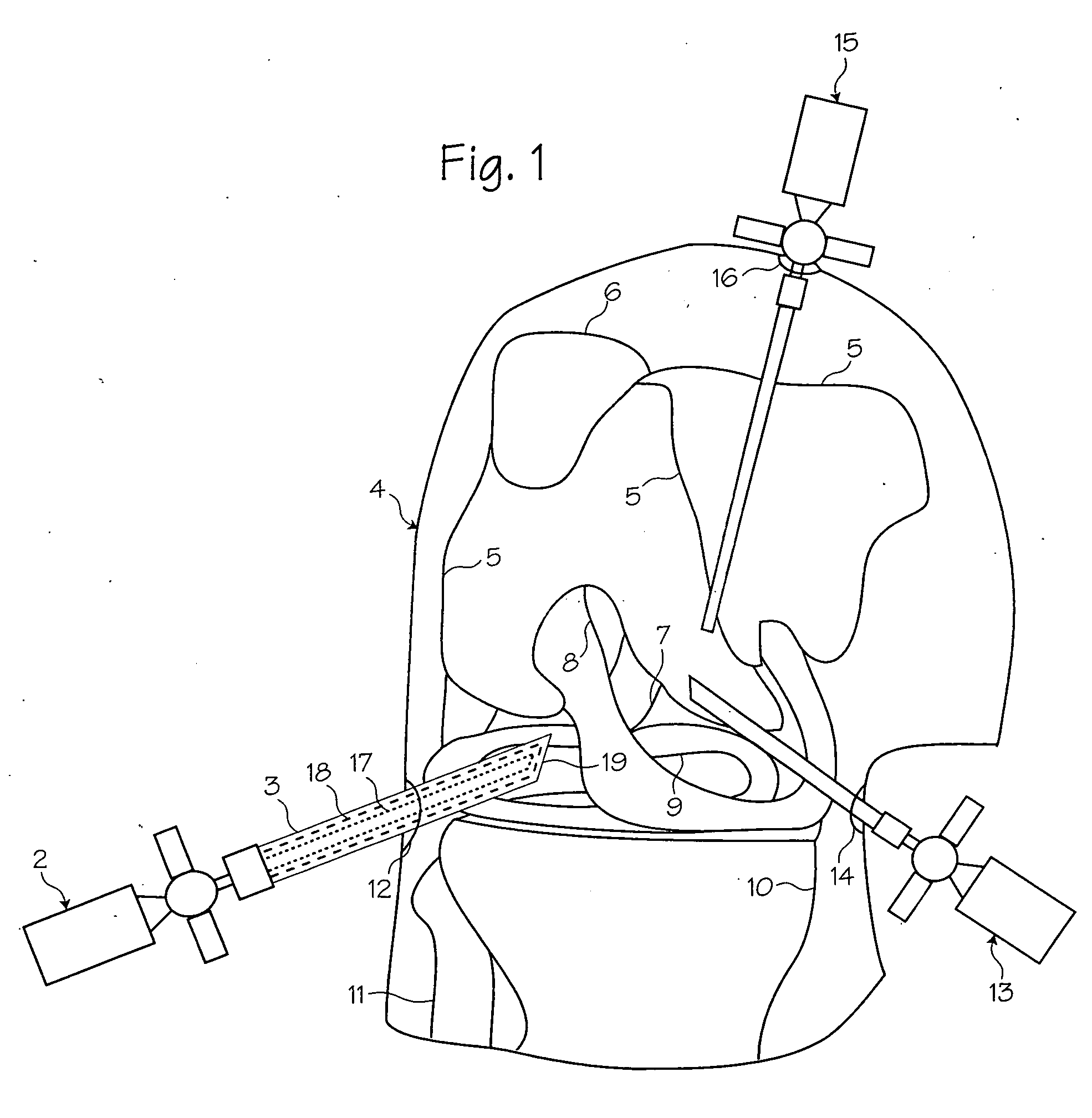 Protective cap for arthroscopic instruments