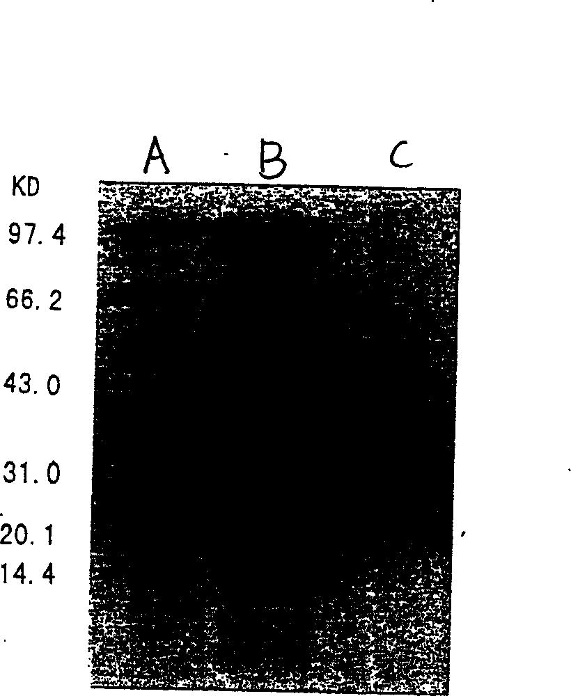 Organophosphorus degradating enzyme and coding gene