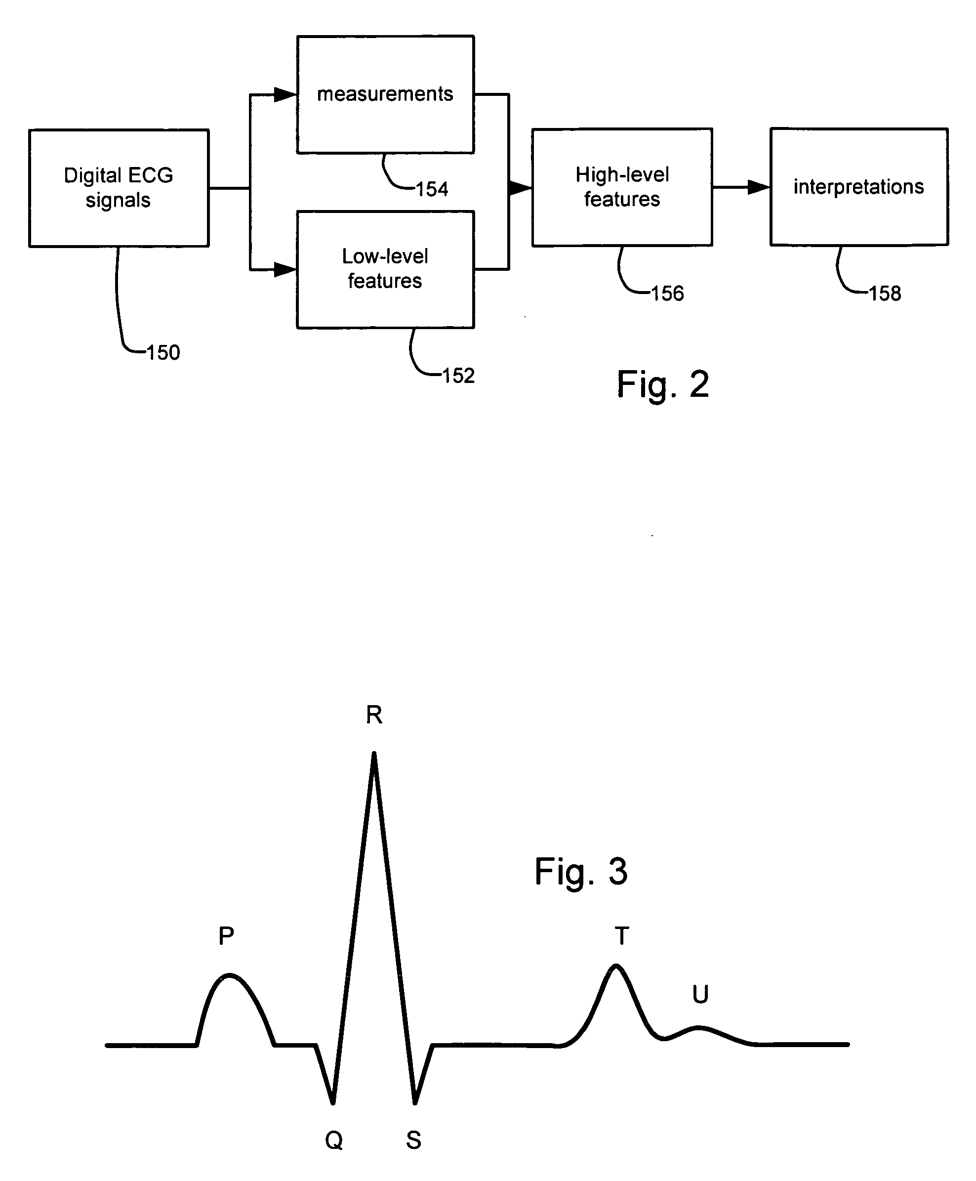 Feature-based editing for electrocardiography