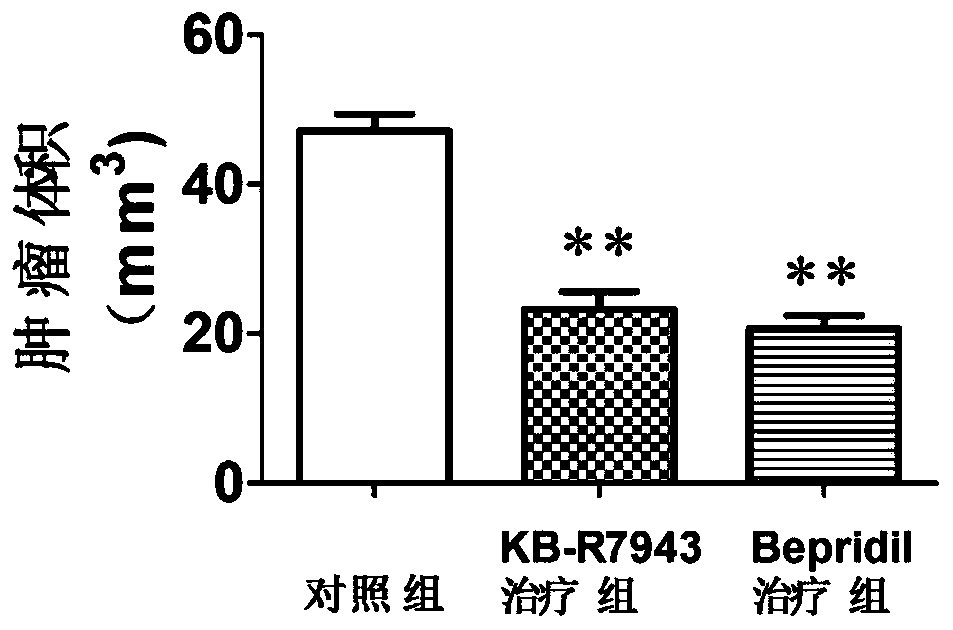 Application of kb-r7943 or bepridil in the preparation of medicine for treating glioma