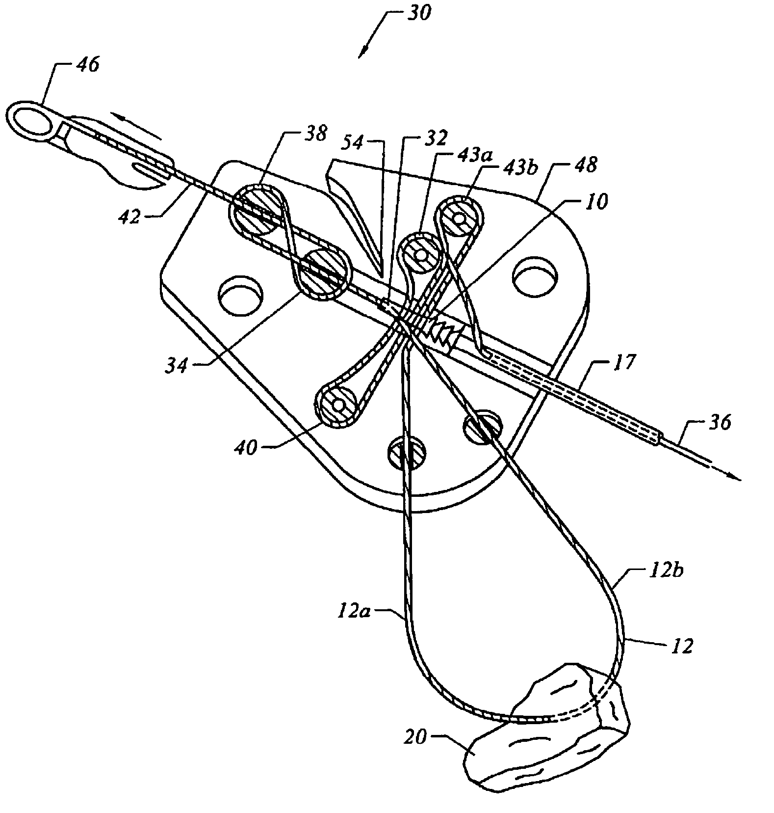 Bone anchor suture-loading system, method and apparatus