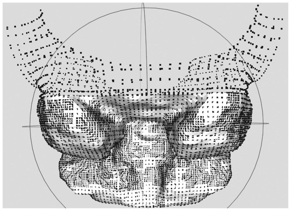 Medical image processing method and device, computer equipment and storage medium