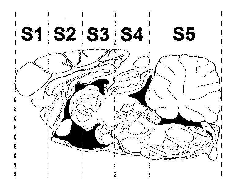 Slow intraventricular delivery