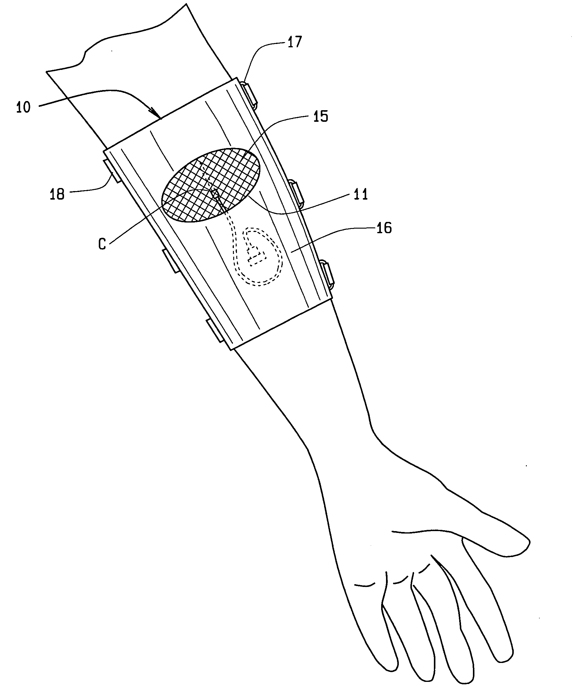 Catheter/IV cover