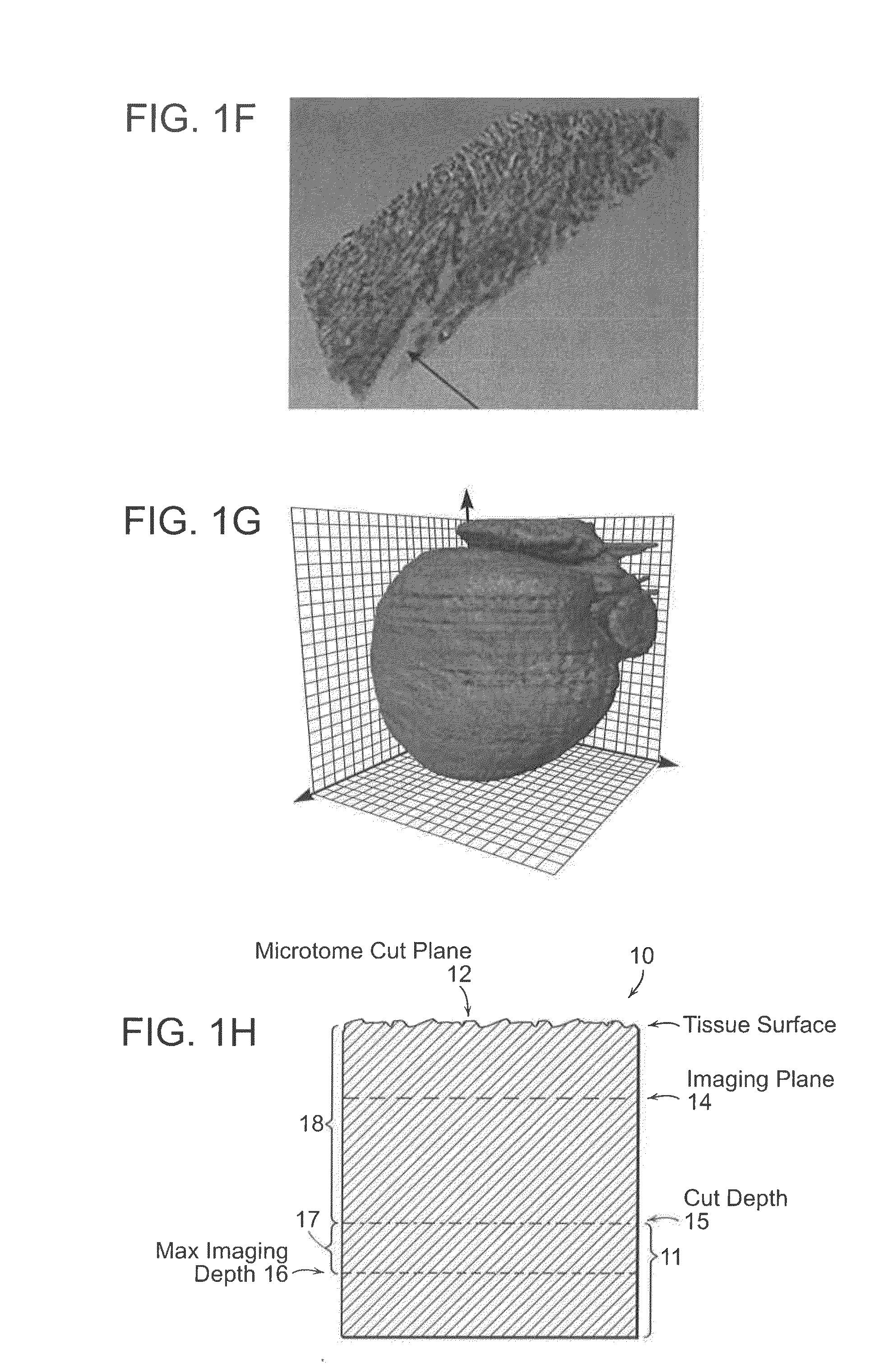 Systems and methods for imaging and processing tissue