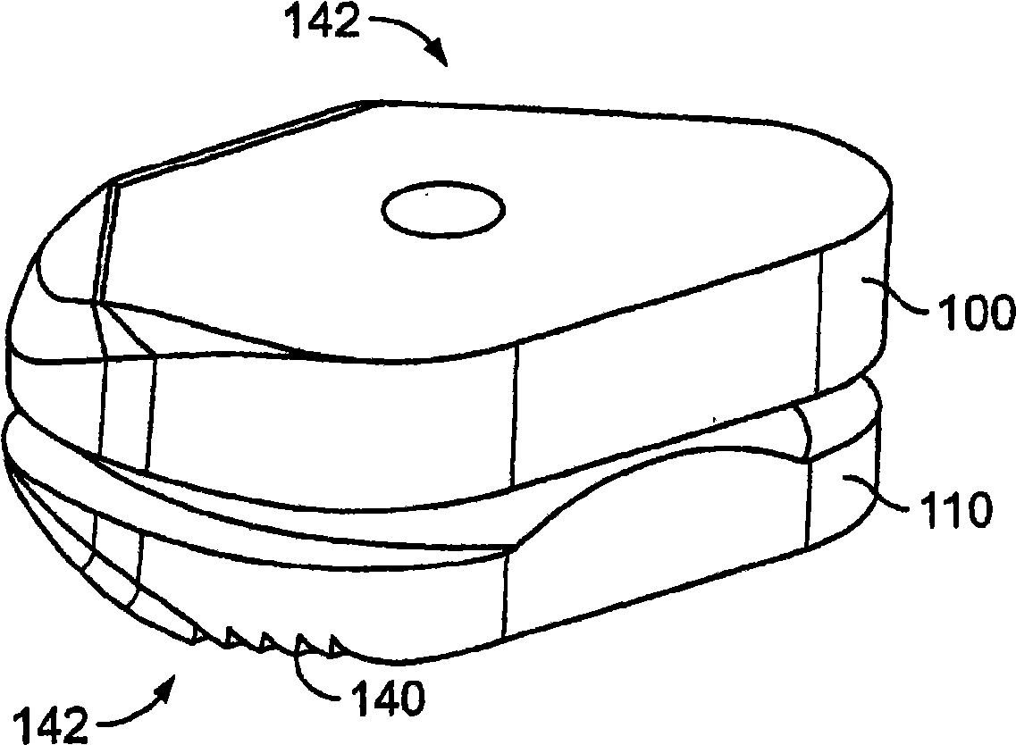 Systems and methods for sizing, inserting and securing an implant intervertebral space