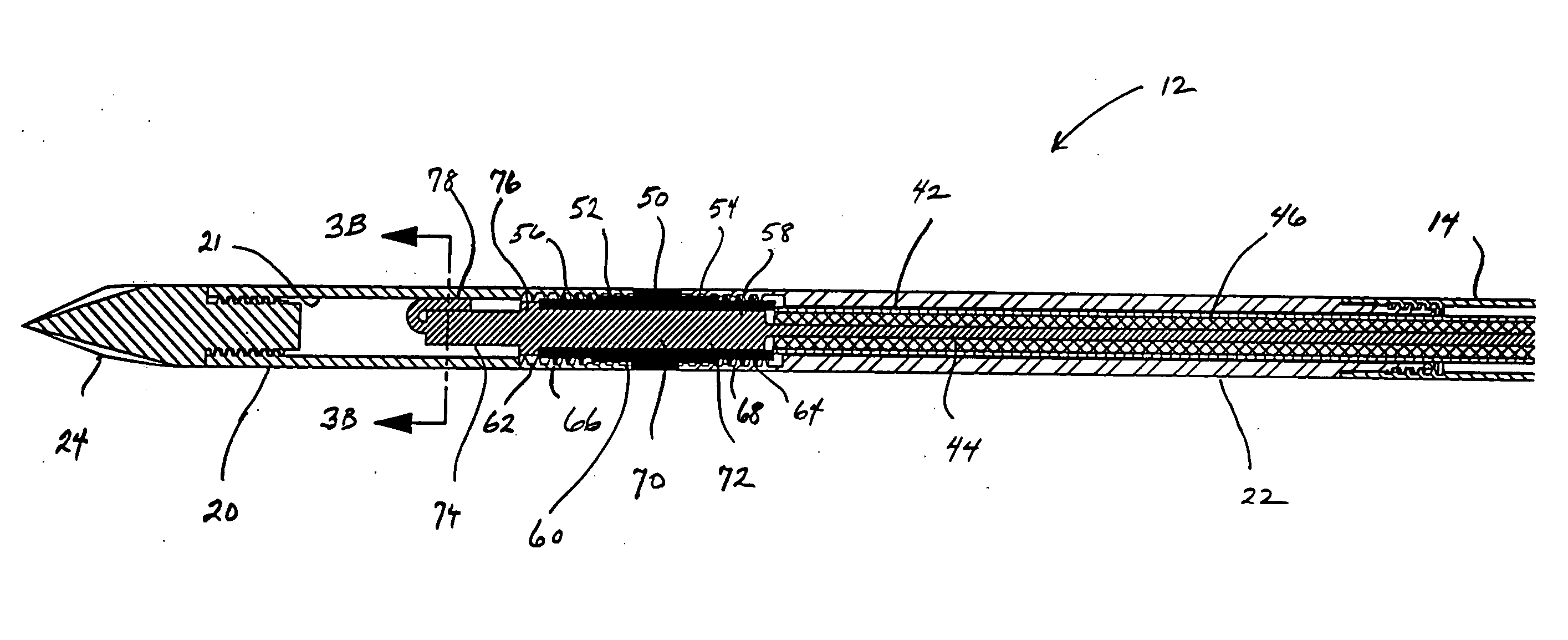 Reinforced high strength microwave antenna