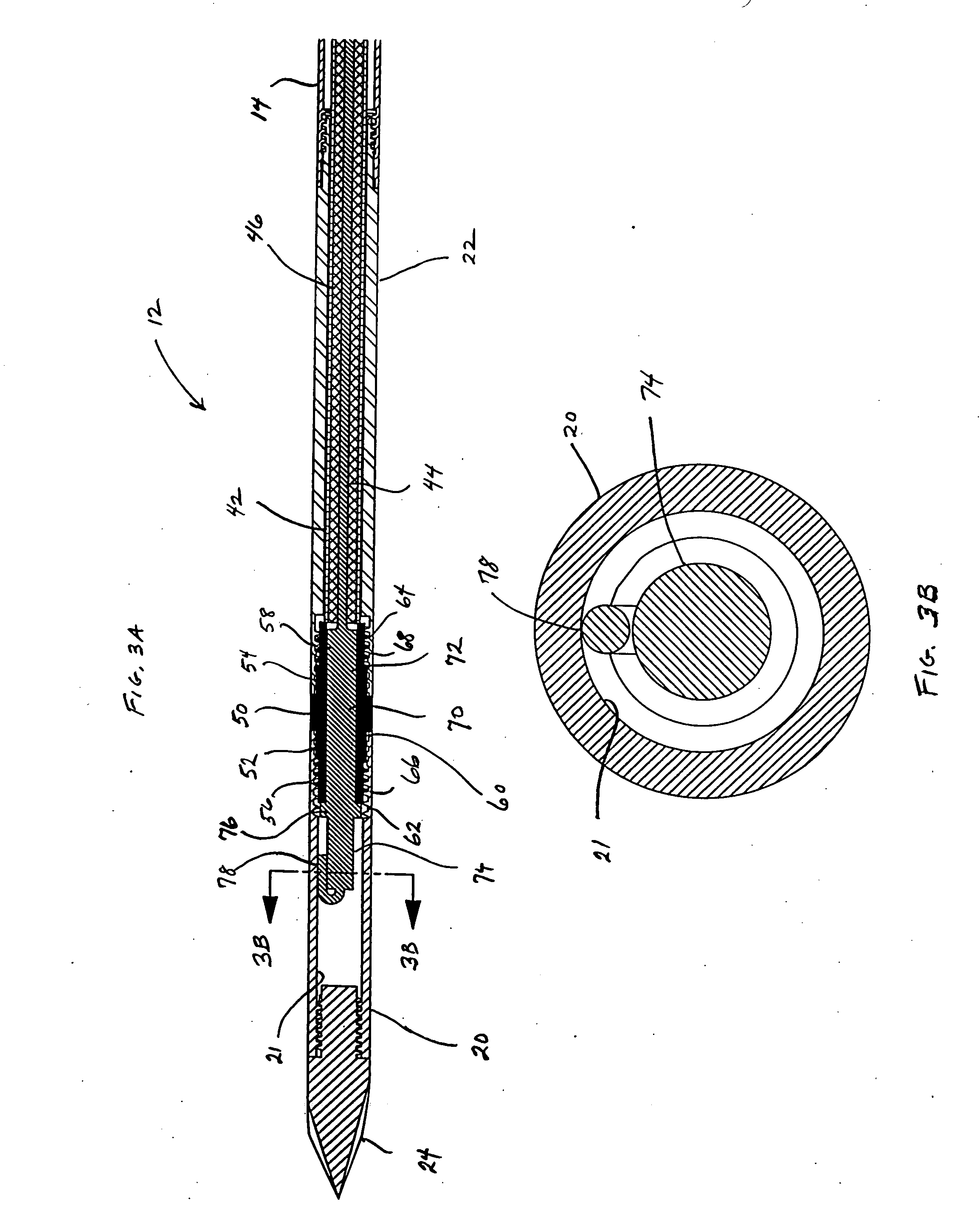 Reinforced high strength microwave antenna