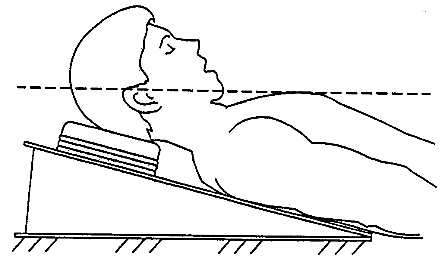 Active head/neck positioning device for endotracheal intubation