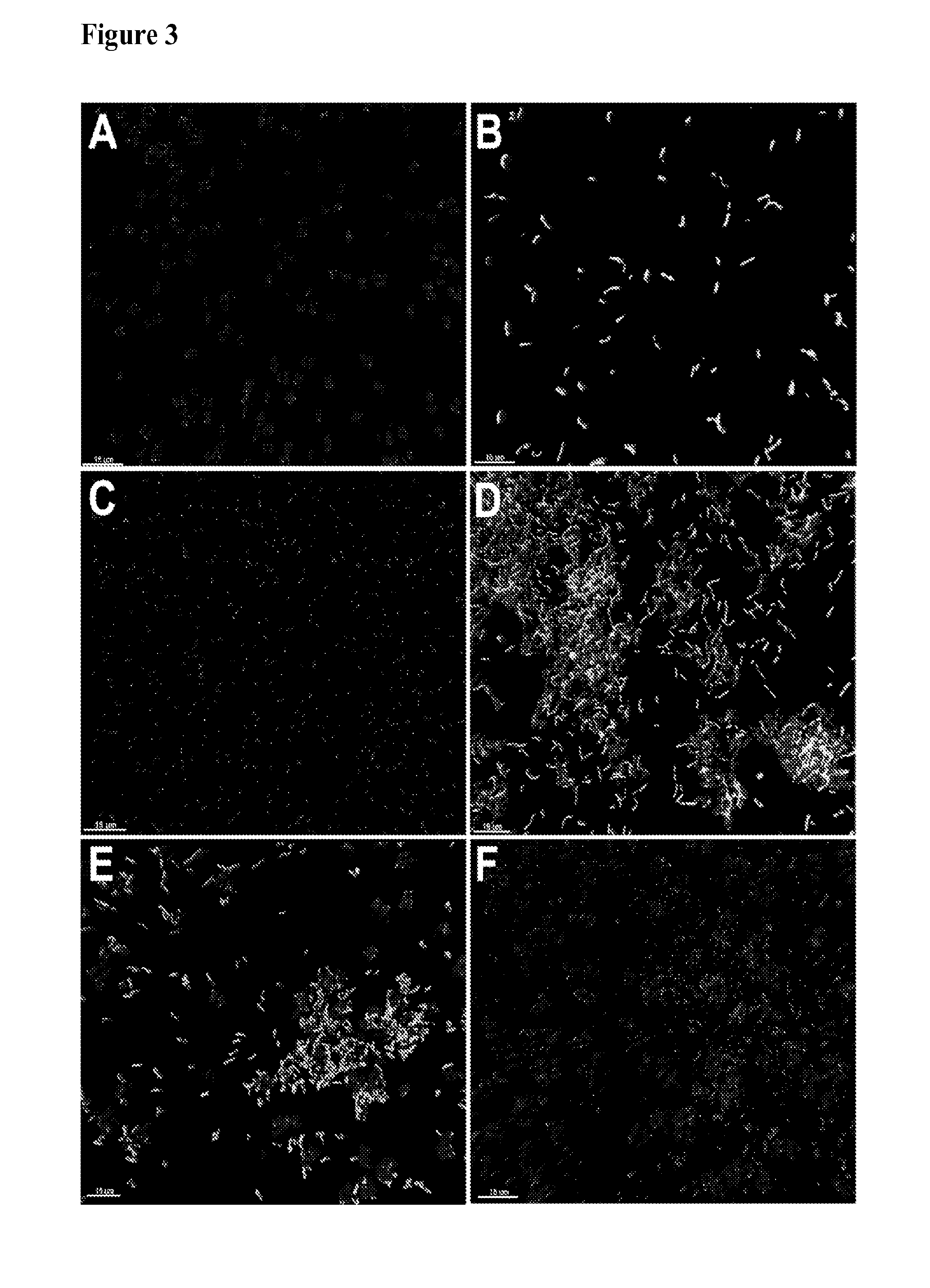 Compositions and method for treating neutralizing microorganisms