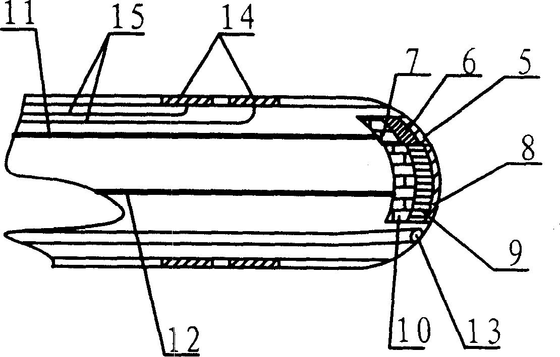 Insertion type ultrasonic locating delivering and irradiating method and insertion type ultrasonic locating injection and irradiation instrument