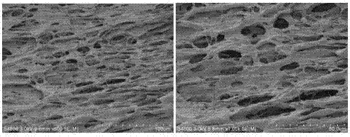 Breviscapine/chitosan composite hydrogel restraining cicatrization and preparation method thereof