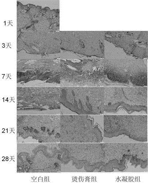 Breviscapine/chitosan composite hydrogel restraining cicatrization and preparation method thereof