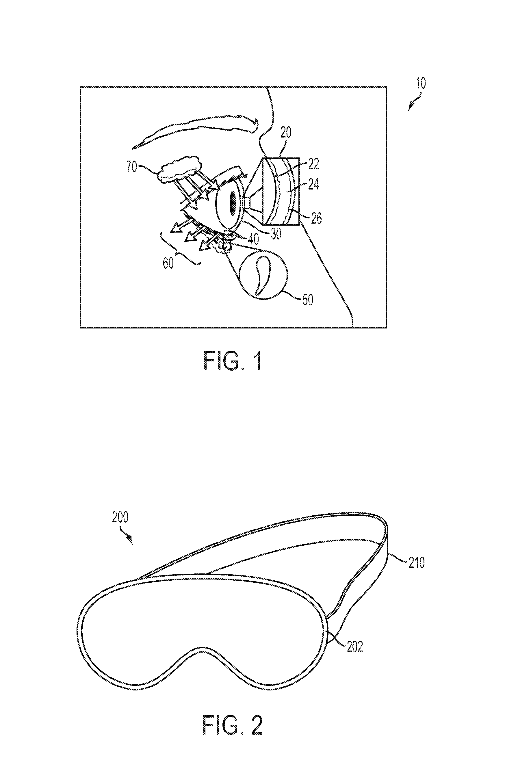 Systems, devices, kits and methods for therapy of the eye