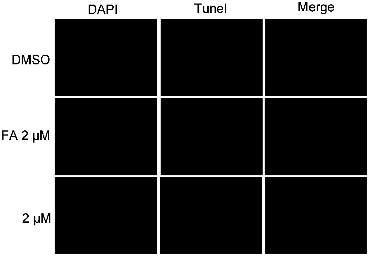 Use of fusidic acid derivatives in preparation of antitumor drugs