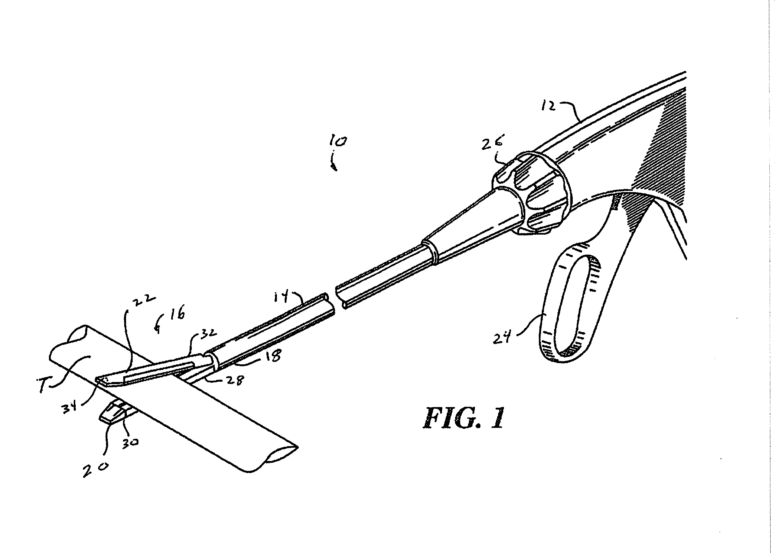 Loose staples removal system