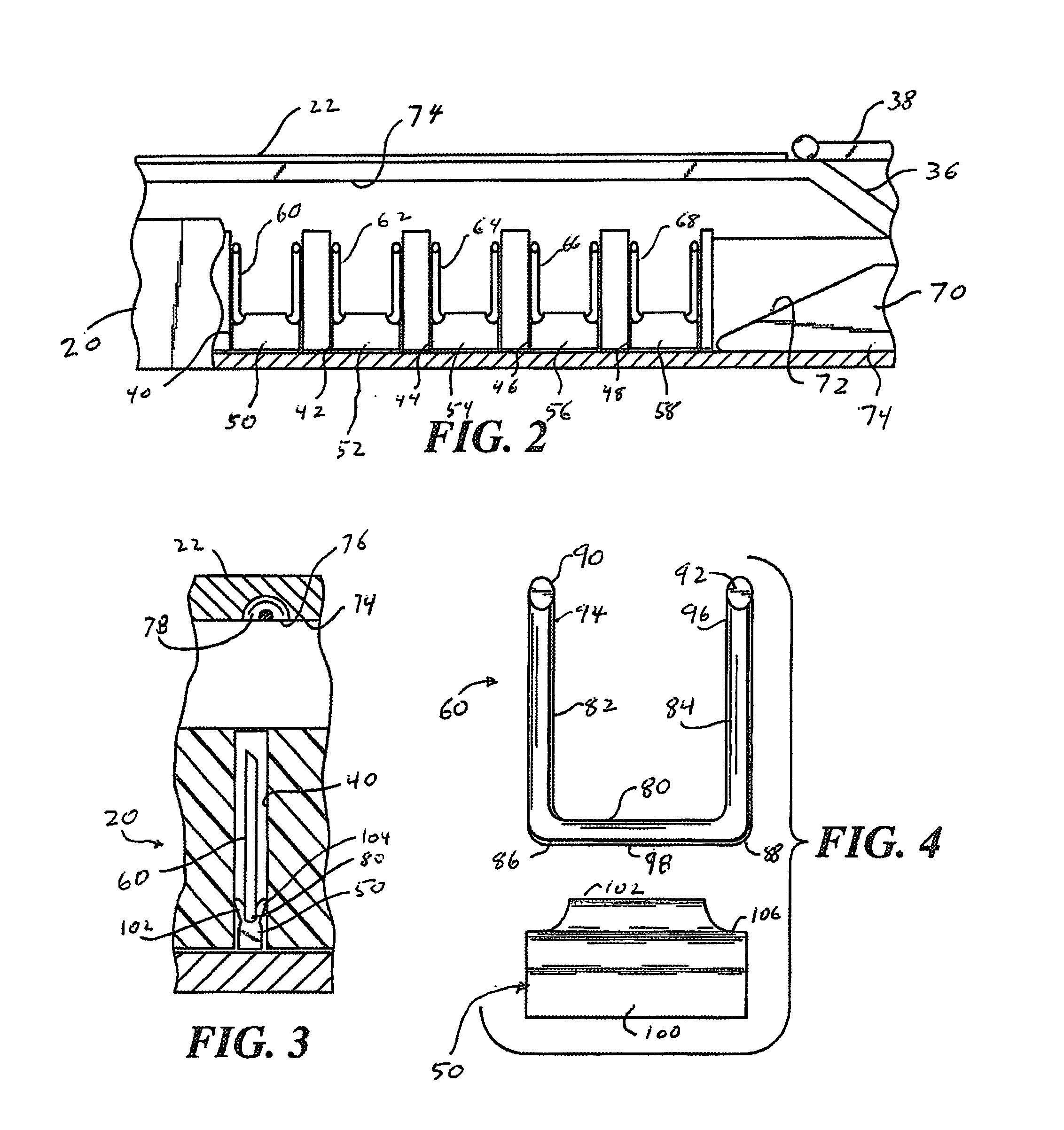 Loose staples removal system