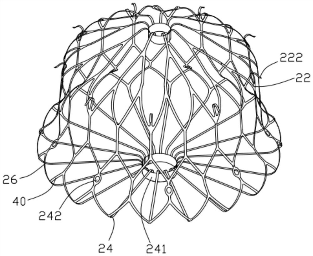 Safety-improved left auricle ablation plugging device