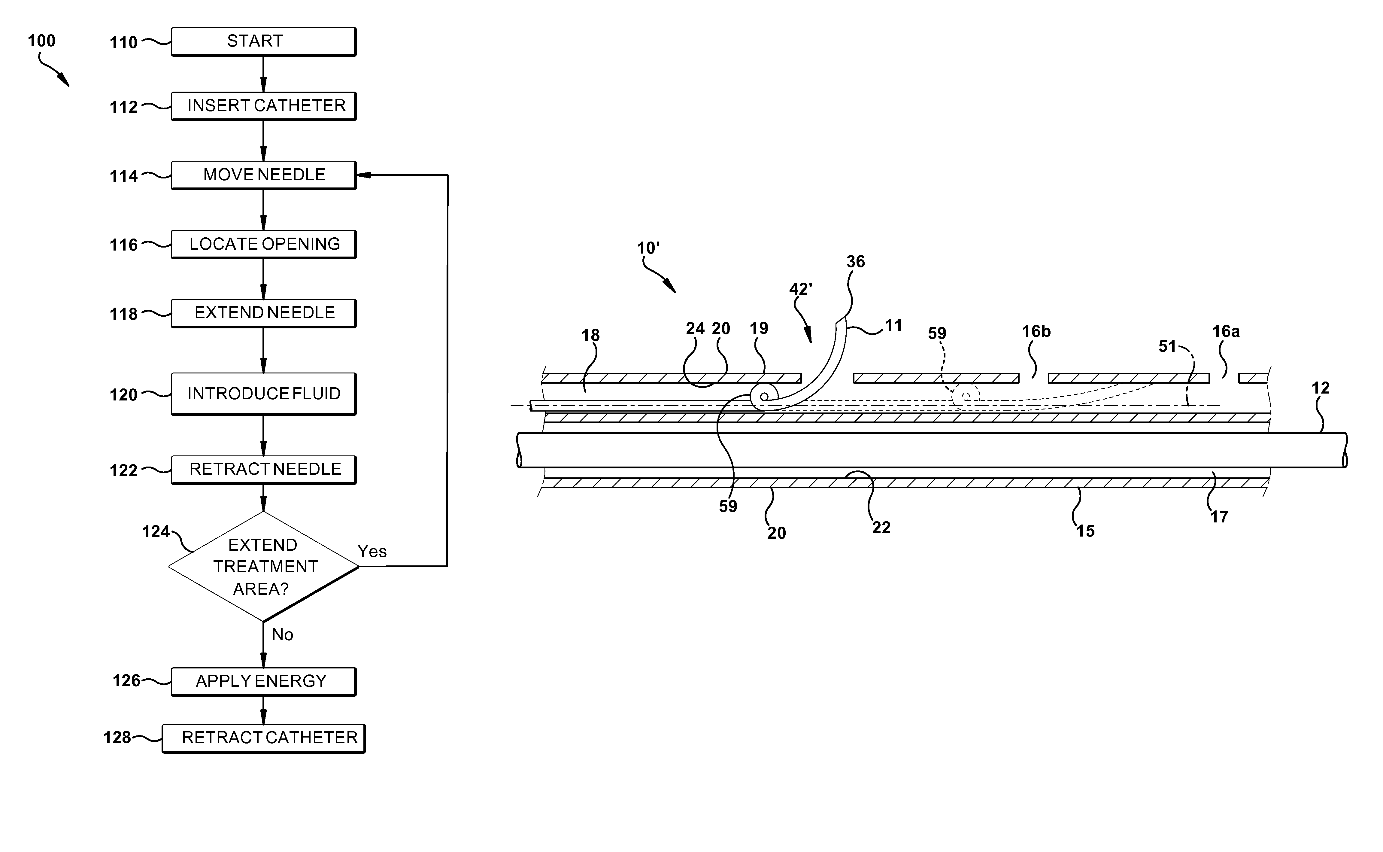 Catheter assembly and method of treating a vascular disease