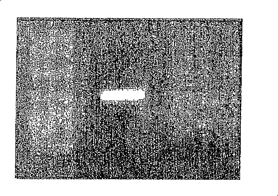 A recombinant virus comprising BPI gene and a pharmaceutical composition containing the same and uses thereof