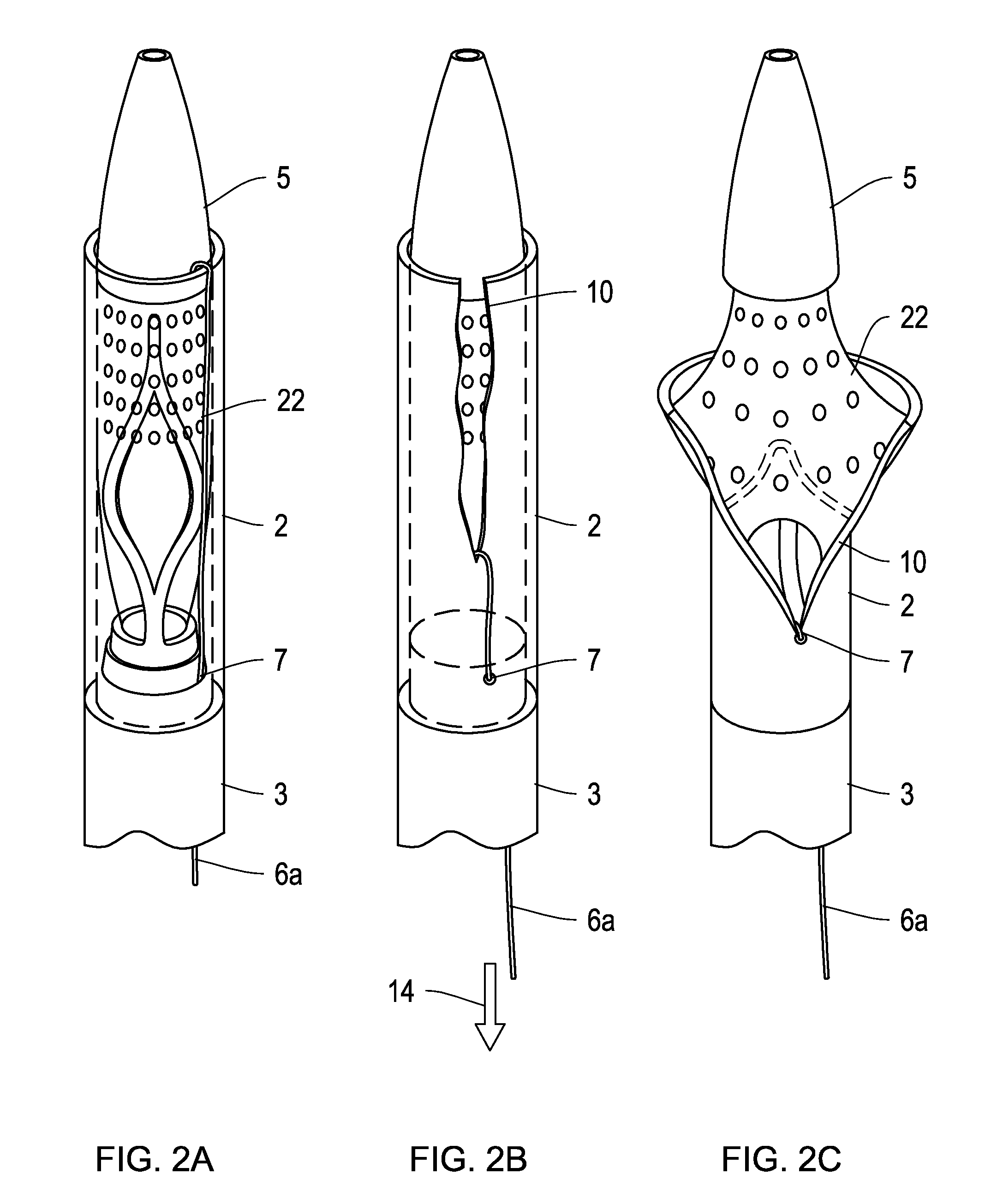 Delivery catheter with constraining sheath and methods of deploying medical devices into a body lumen