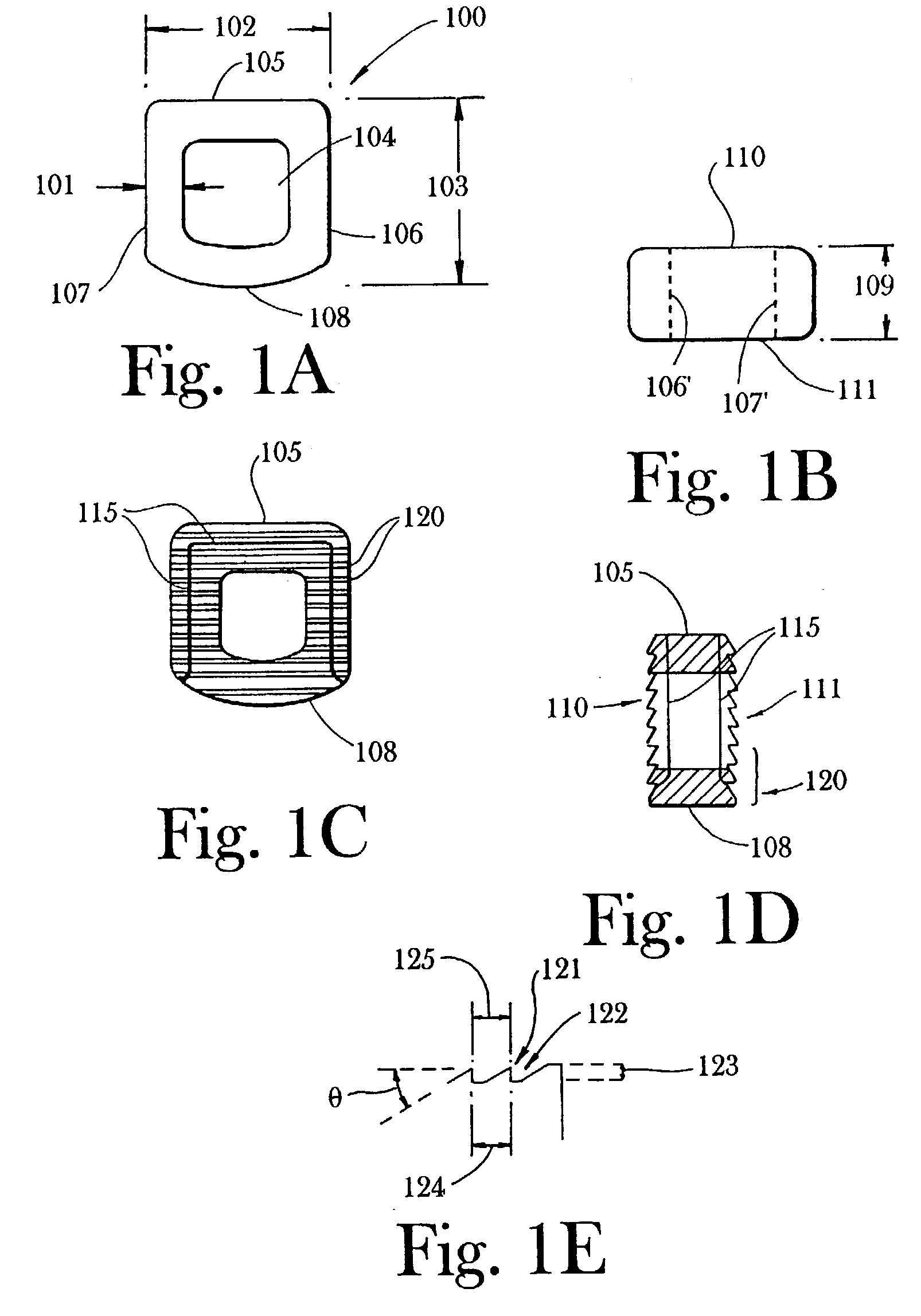 Cortical bone-based composite implants