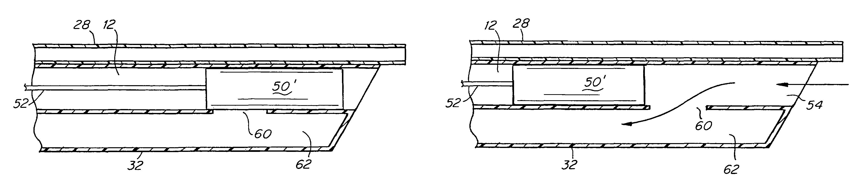 Aspiration catheter having an internal vacuum accumulator