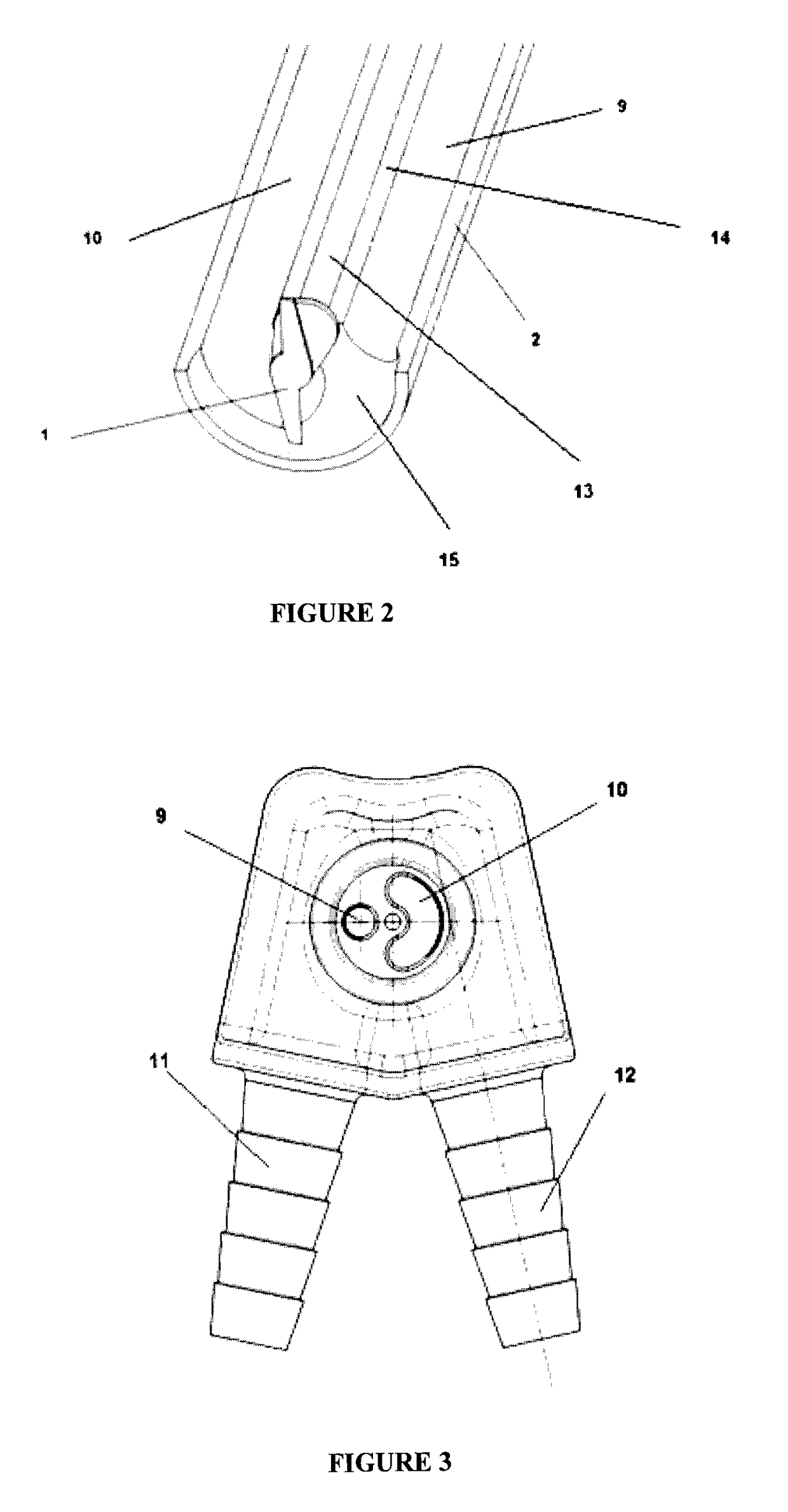 A device used in the implementation of laparoscopic hydatid cyst operations