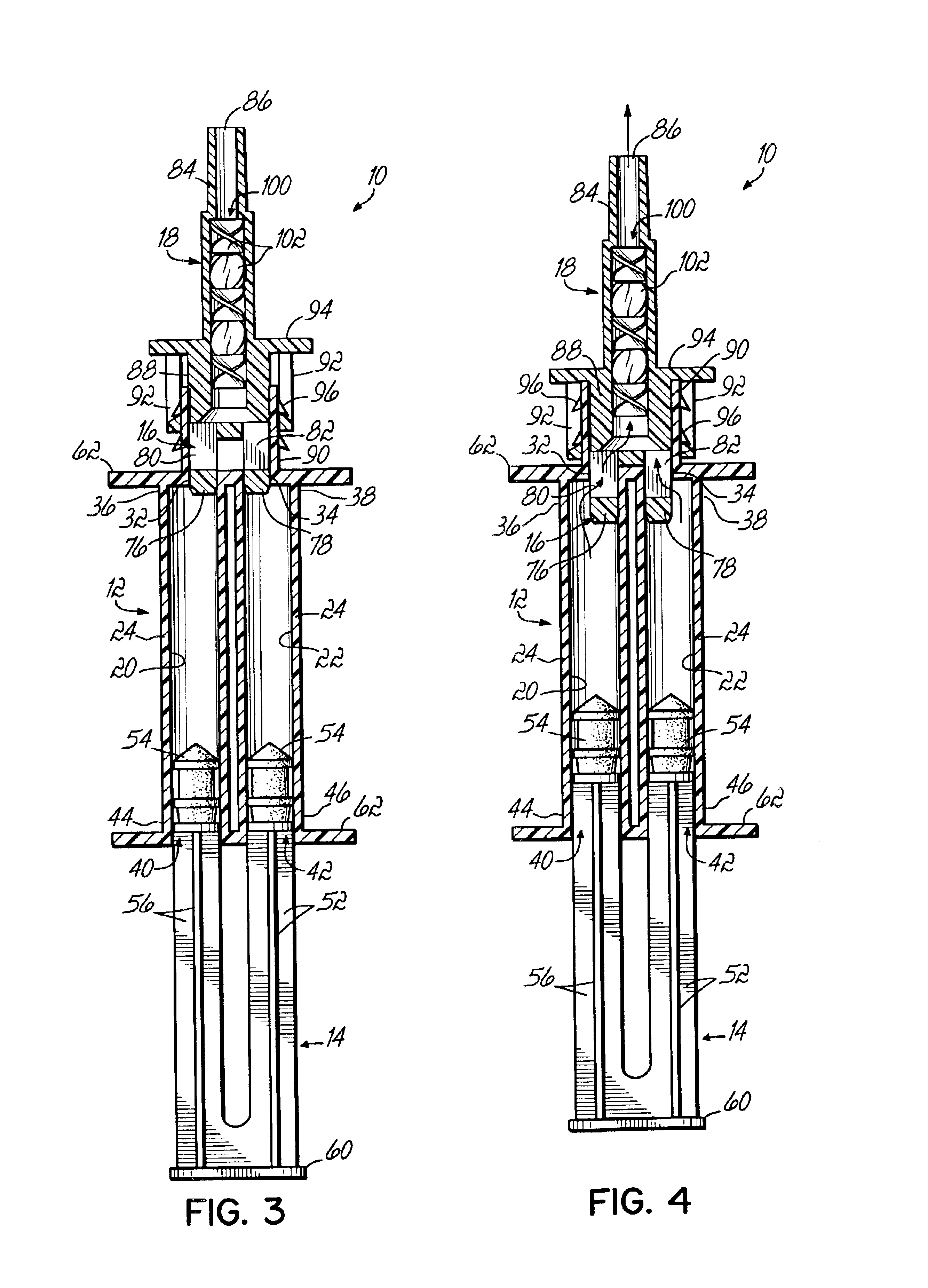 Single dose dental impression material delivery system and method