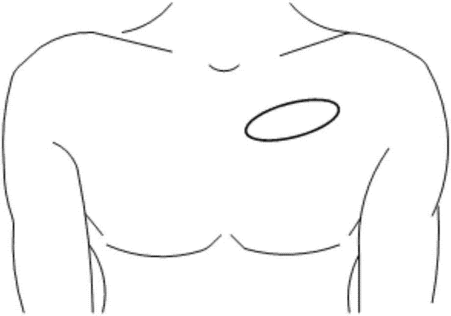 Equipment, system and method based on heart rate detection obstructive sleep apnea syndrome