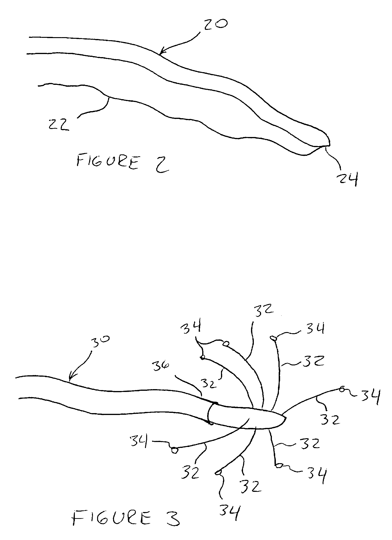 CT-Enhanced Fluoroscopy