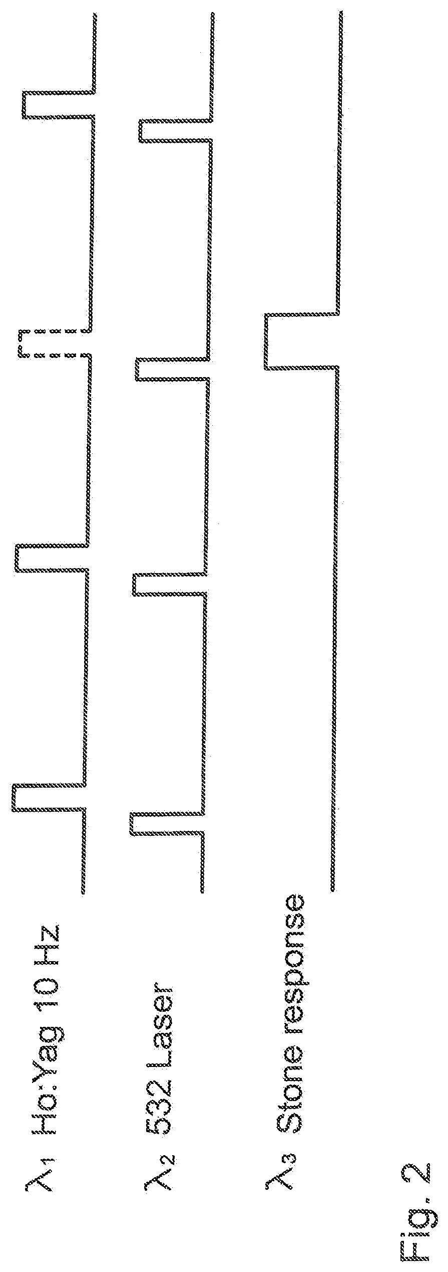 Stone sense with fiber erosion protection and camera saturation prevention, and/or absence-detection safety interlock