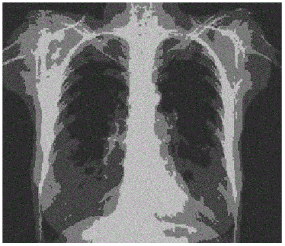 Clustering integration method for image data of X-ray films