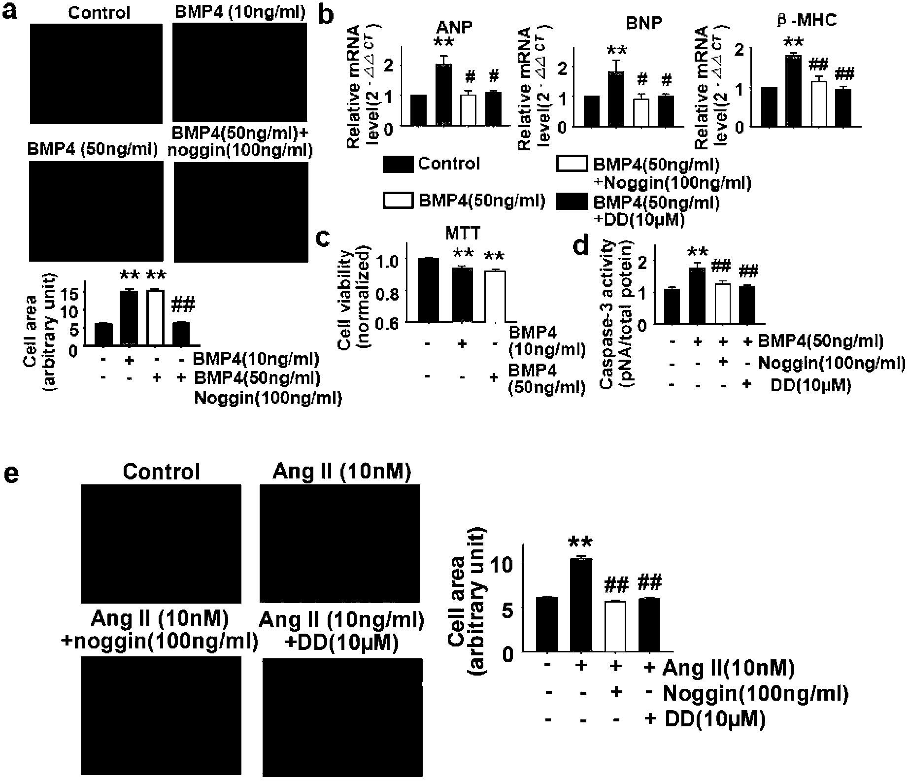 Application of bone morphogenic protein-4 in screening anti-cardiac hypertrophy, anti-heart failure or anti-cardiac fibrosis drugs