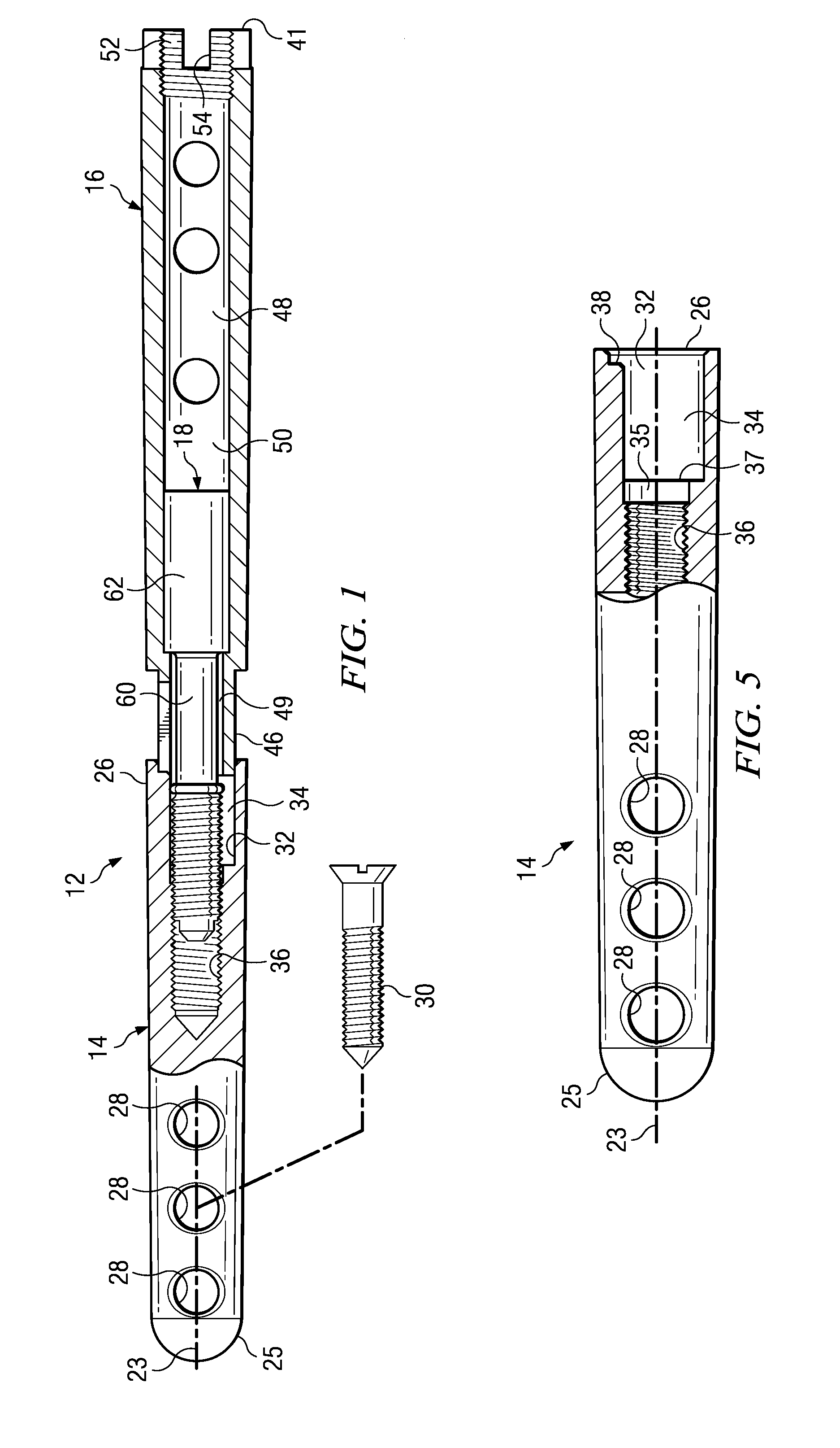 Ankle arthrodesis nail and outrigger assembly