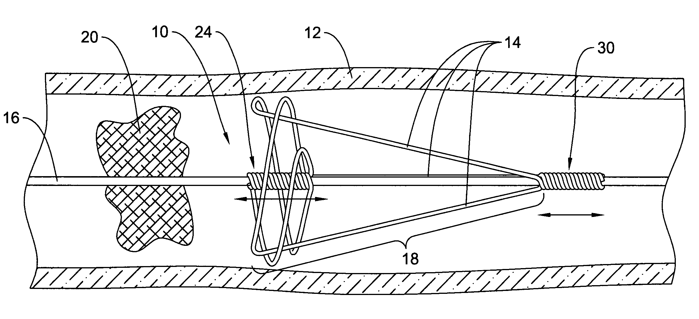 Clot removal device