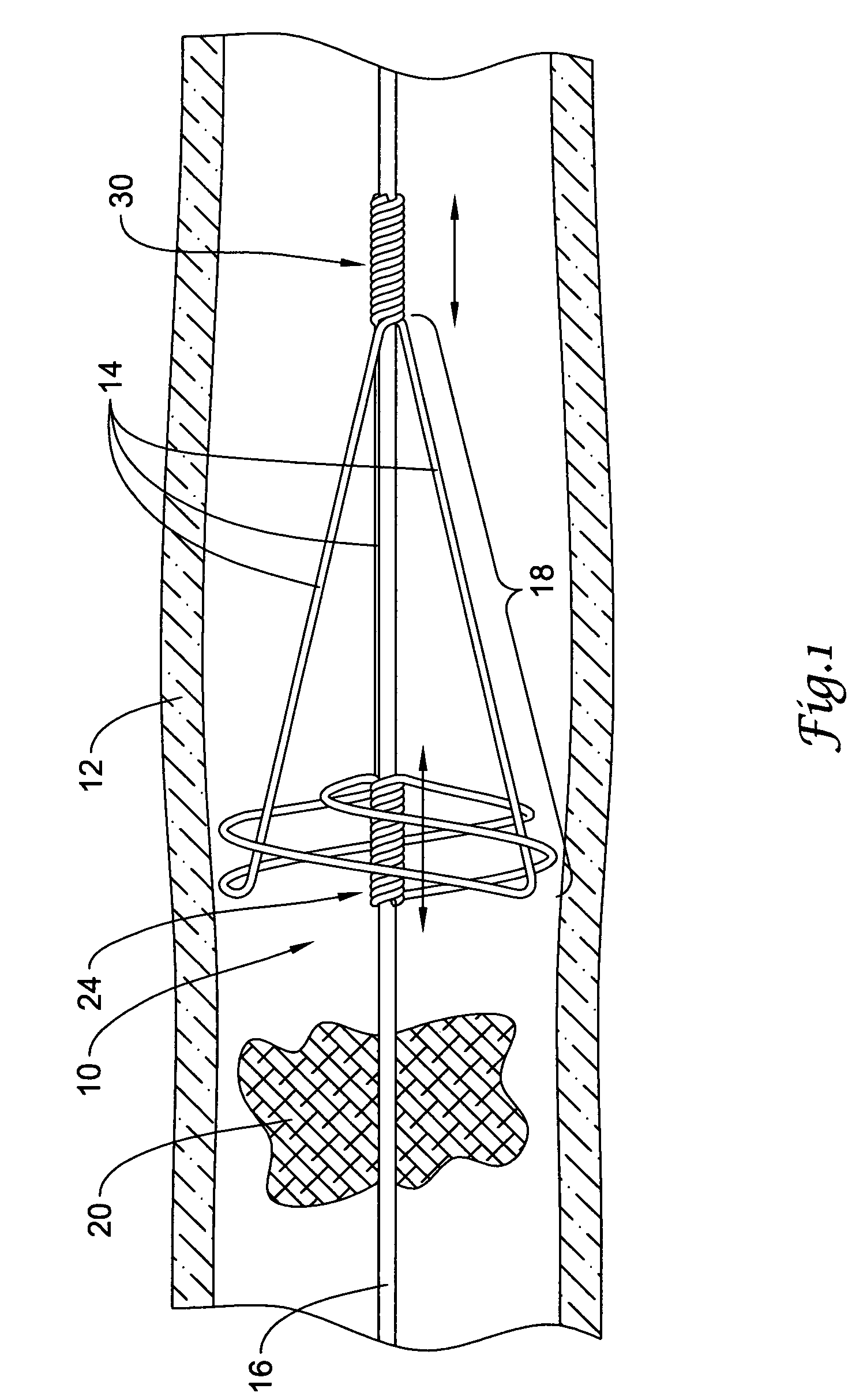 Clot removal device