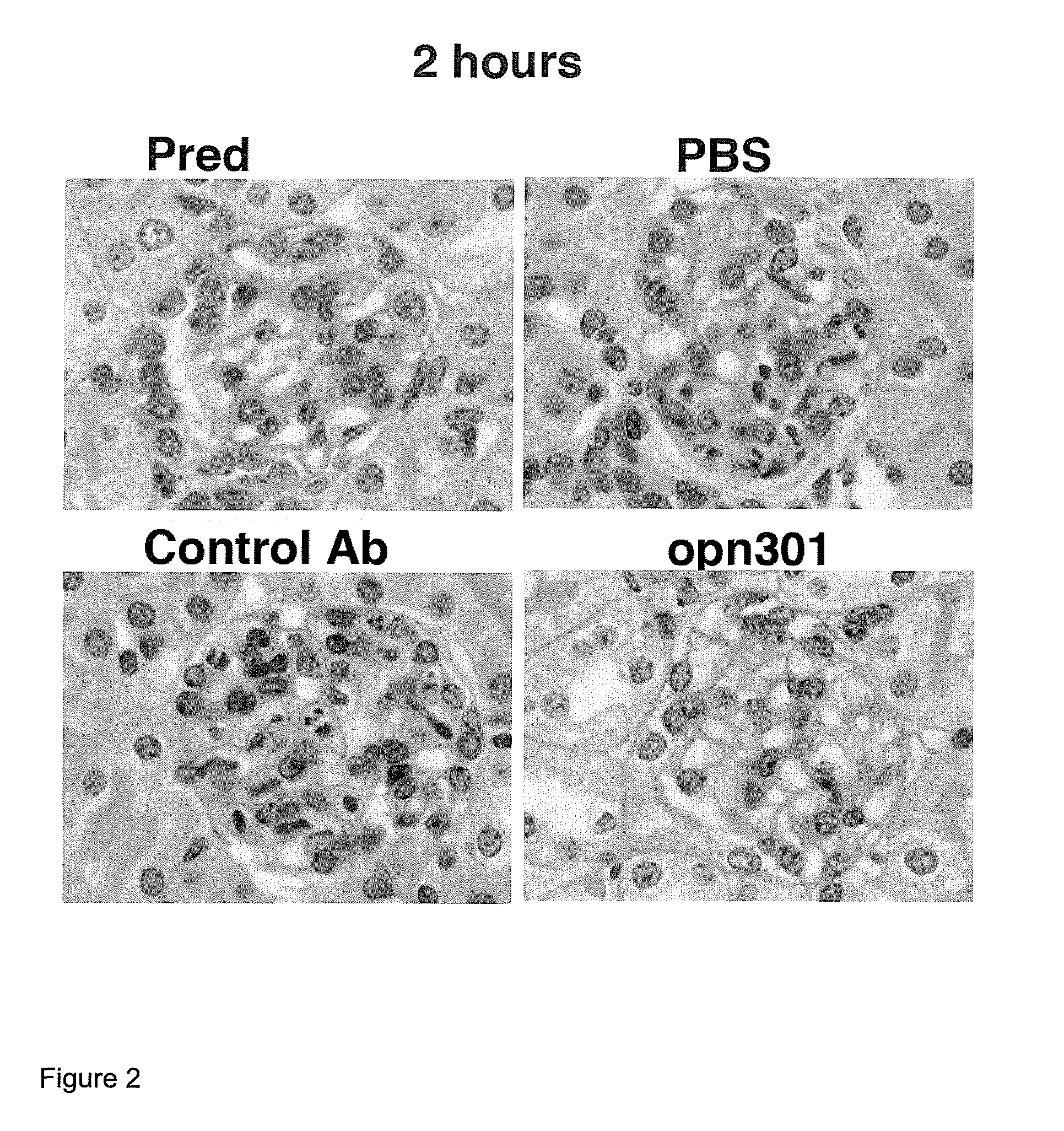 Compounds and methods for the treatment of renal disease