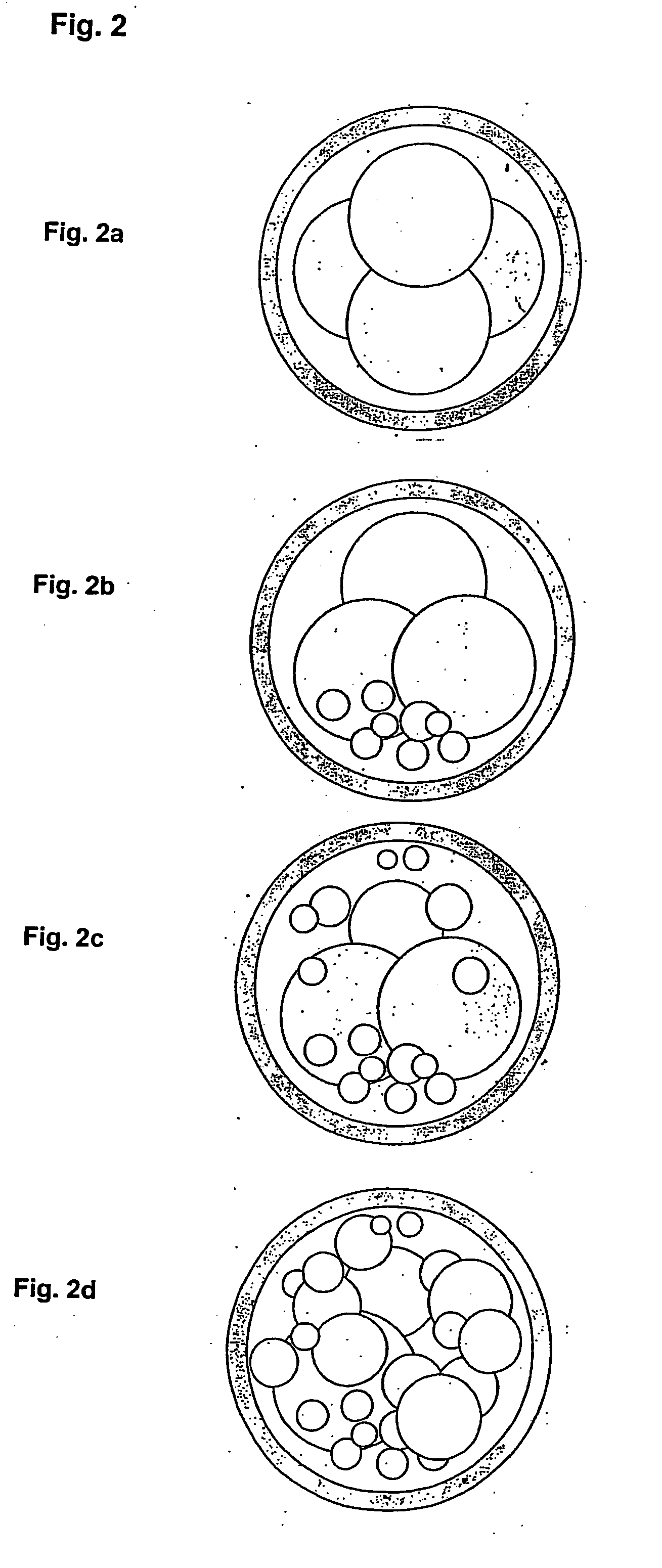 In vitro fertilisation