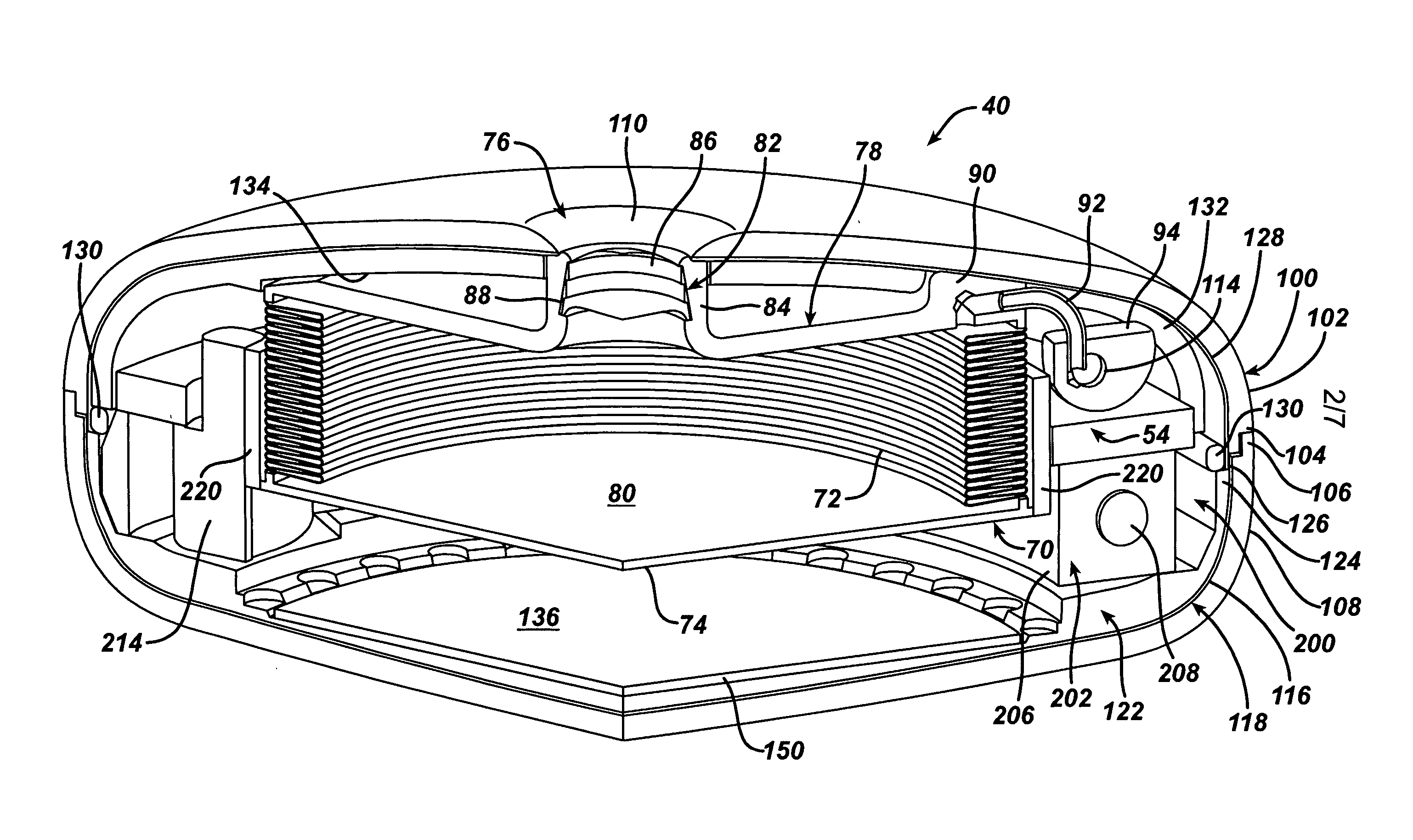 Thermodynamically driven reversible infuser pump for use as a remotely controlled gastric band