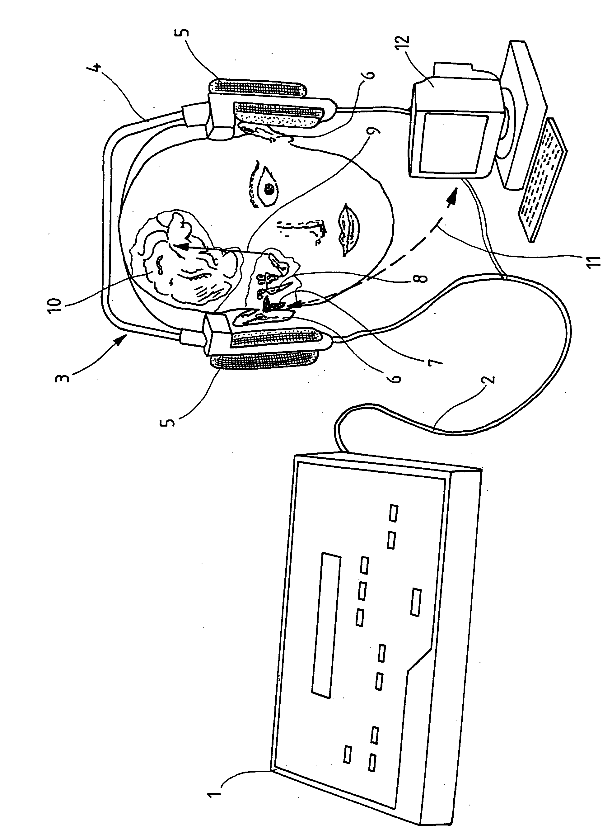 Device and method for configuring a hearing aid