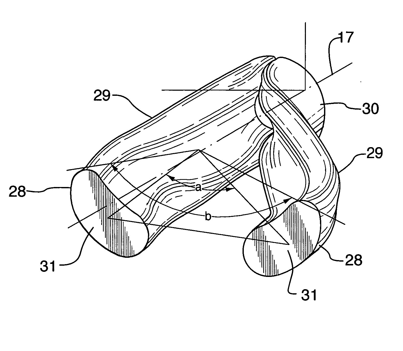 Hybrid inlet