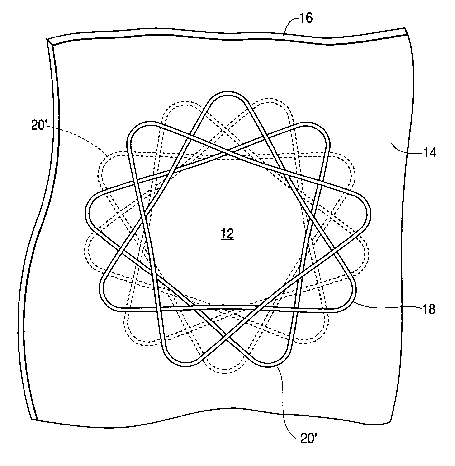 Anastomotic device