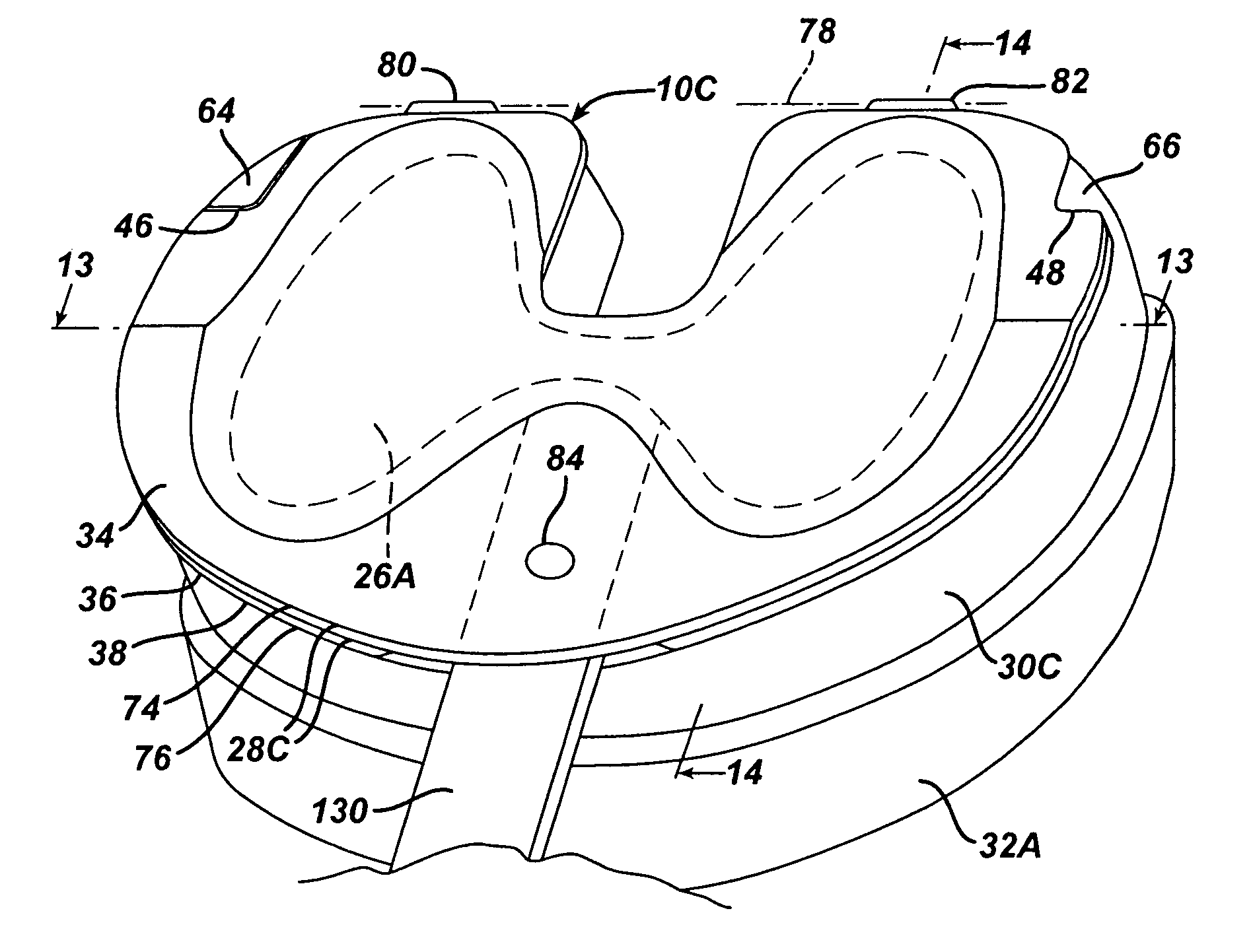 Modified system and method for intraoperative tension assessment during joint arthroplasty